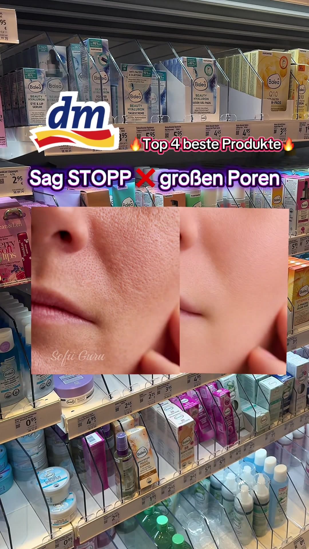 @sofii.guru — Große Poren? Ich dachte ehrlich, man kann nichts machen…