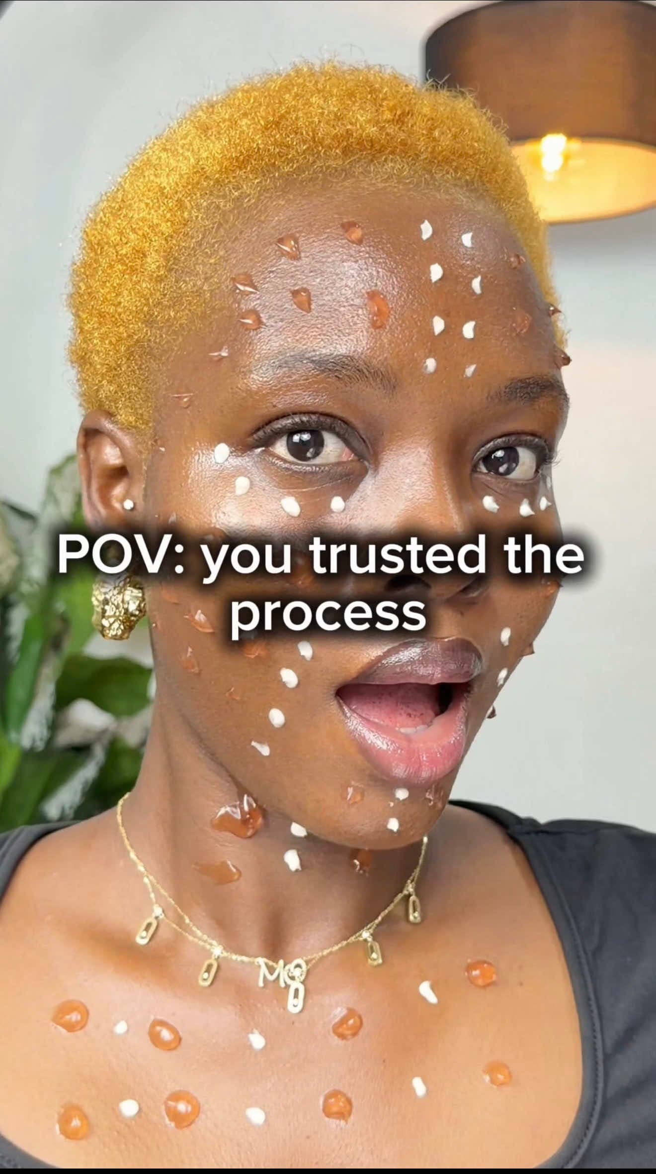@moskinatelier — POV: you trusted the process to fix your dehydrated skin🤩