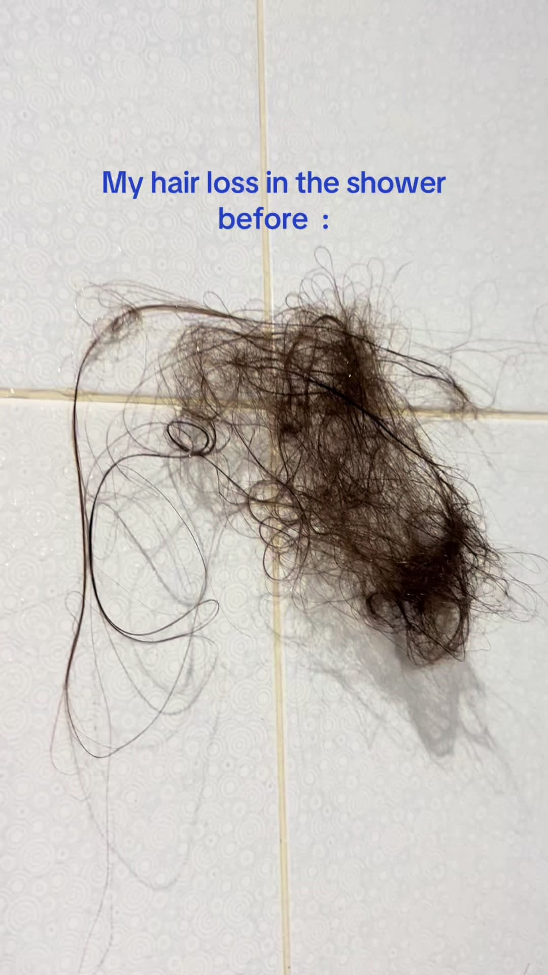 @ayastipssss — I was losing 250+ hairs every time 😮‍💨 #hairloss #haircareroutine #hairwashday 
