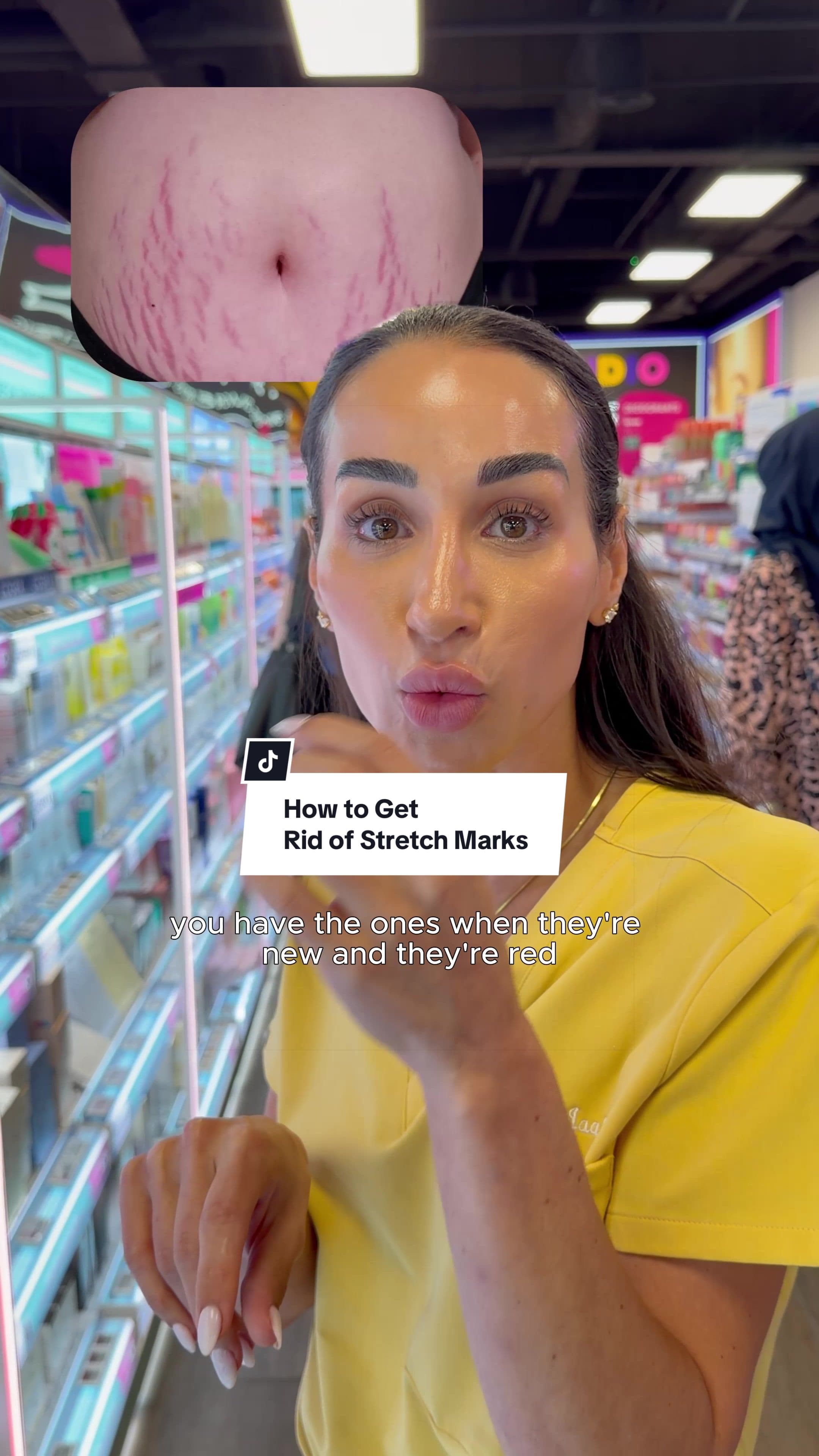 @dr.nora.uk — If you’re worried about stretch marks this one’s for you x 