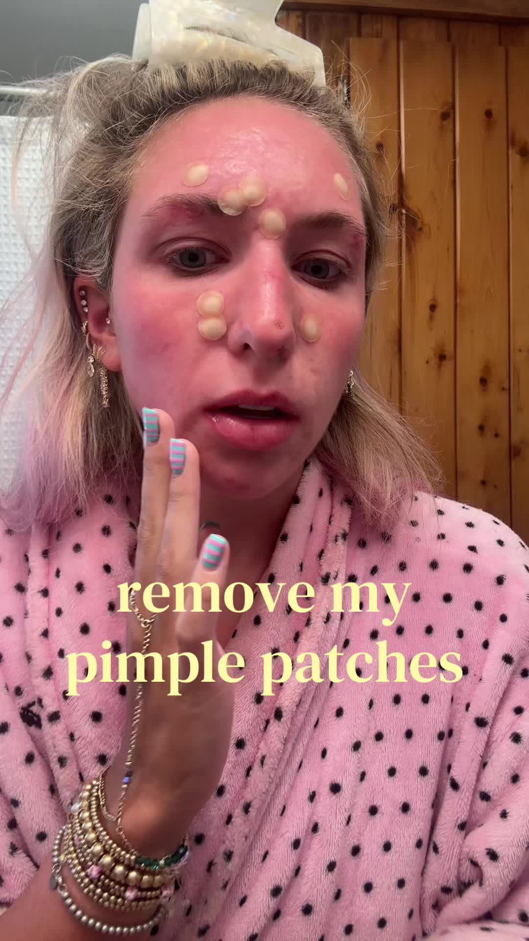 @juliayuro — Patches from @Peace Out Skincare #dermatillomania #ocd #skinpickingdisorder #accutanejourney #pimplepatchremoval 